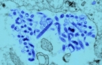 Virus