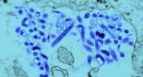 Virus