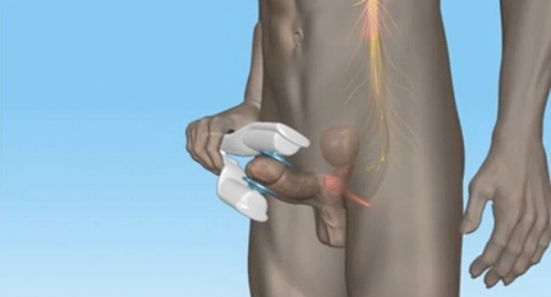 Vibrator