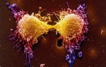 Tumor