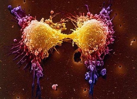 Tumor