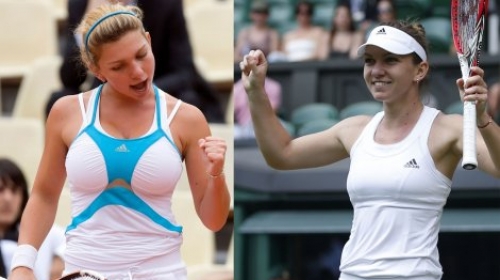 Simona Halep pre i posle intervencije