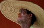Oboljenje kože Foto: AP
