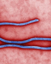 Virus ebole, jedne od najmučnijih boljki ikada