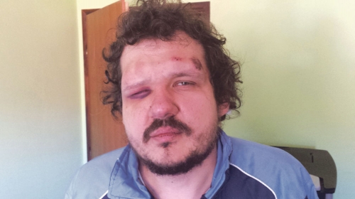 Brutalno pretučen: Tomislav Milovanović