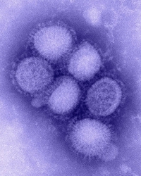 H1N1 Virus