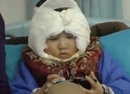 Kina dete