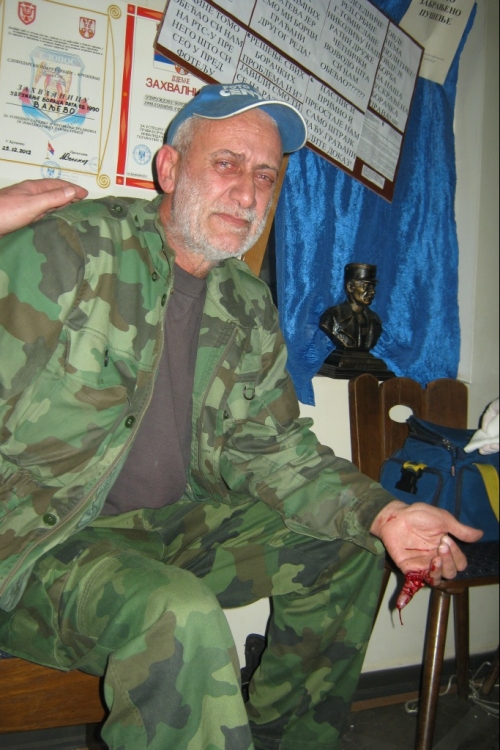 Osakaćeni borac