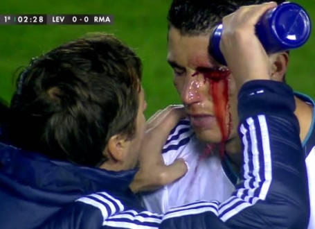Kristijano Ronaldo