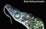 Naegleria fowleri