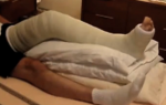 gips