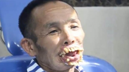 Napad vuka
