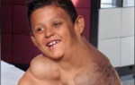 Dečaku izvađen tumor