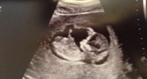 Fotografija bebe koju je okačila na tviter