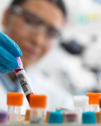 Analiza krvi HIV pozitivnih osoba