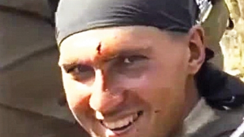 Osmeh uz nemali ožiljak  za kraj!