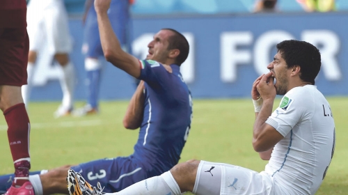 Boleli ga zubi nakon ujeda: Luis Suarez