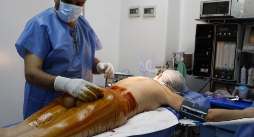 Silikoni u zadnjici | Foto: Reuters | Foto: 