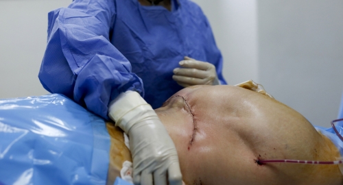 Silikoni u zadnjici | Foto: Reuters | Foto: 