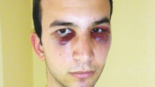 Povređeni  Nikola Kalanj