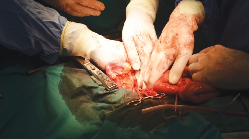 Prema predlogu izmene Zakona o transplantaciji, svi građani Srbije biće potencijalni donori, osim ako to izričito odbiju