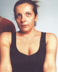 Novinarka  B92 prošla sa  modricama