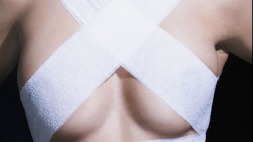 Plastične operacije nisu rešenje za propalu vezu