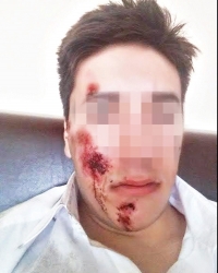 Umesto zabave, dobio batine: Student V. Đ.