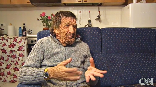 Vinićio  živi u  Vićenci