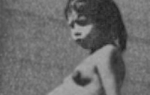 Lina Medina, najmlađa mama u istoriji