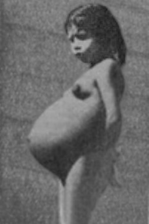 Lina Medina, najmlađa mama u istoriji