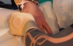 Čip se ubaciju između palca i kažiprsta
